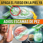 ¡¿Tu Piel Parece “Escamas de Pez” por la Psoriasis?! Apaga el Fuego y Derrite las Costras con Sábila y Avena Helada