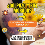 “Sana, Sana, Colita de Rana”: Por qué la Árnica es la Reina de los Golpes en México