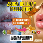 ¿Boca de Lija por el Viento? El “Beso de Miel” que Rescata tus Labios en 2 Minutos